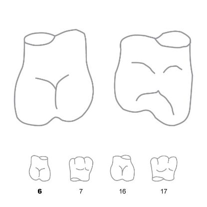 Crown Forms Clear (Unodent) Molars Right 6 x 5