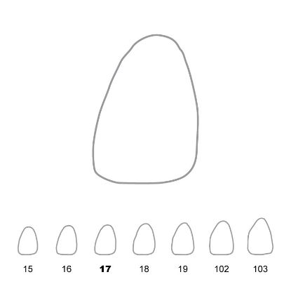 Crown Polycarbonate (Directa) Upper Central Incisors Left 17 x 5