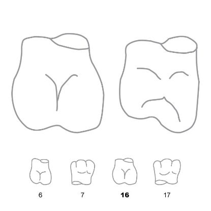 Crown Forms Clear (Odus Pella) Molars 16 x 1 Pair