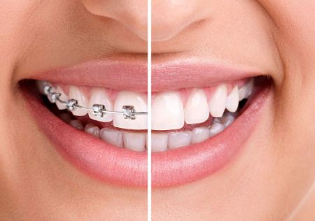 Picture for category Orthodontics